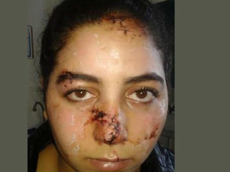 വിവാഹ മോചനം ആവശ്യപ്പെട്ട ഭാര്യയുടെ മുഖം വികൃതമാക്കി, വീഡിയോ