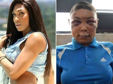 ലൈംഗികസംതൃപ്തിക്ക് ശ്രമിച്ച ഭിന്നലിംഗക്കാരിയെ പരസ്യമായി മര്‍ദ്ദിച്ച്നഗ്നയാക്കി,ദൃശ്യം പ്രചരിക്കുന്നു