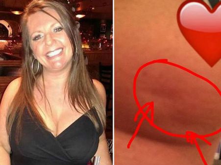 കാന്‍സര്‍ ബാധിച്ച സ്തനങ്ങളുടെ ചിത്രം യുവതി ഫേസ്ബുക്കില്‍ പോസ്റ്റ് ചെയ്തു, ചിത്രം വൈറല്‍