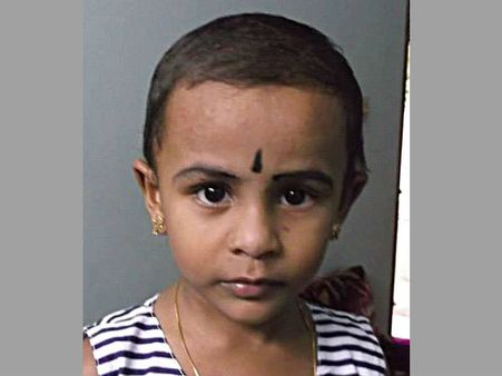 മൂന്ന് വയസ്സുകാരി അഞ്ജന ഇനിയും ജീവിയ്ക്കും... കണ്ണിലും കരളിലും