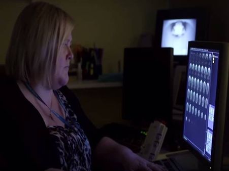 പോണ്‍ സ്ഥിരമായി കാണുന്നവരുടെ തലച്ചോര്‍ ചുരുങ്ങും, ലൈംഗിക സംതൃപ്തി കുറയും, കാണൂ