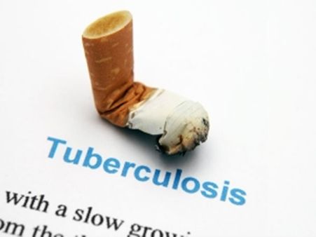 ഇന്ത്യയില്‍ ക്ഷയരോഗികള്‍ പെരുകുന്നു, 1.5 ലക്ഷം ആളുകള്‍ മരിച്ചു