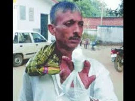 മുന്നുവട്ടവും നിതീഷ് കുമാര്‍ തന്നെ മുഖ്യമന്ത്രി, അനില്‍ ശര്‍മ്മ മൂന്നാമത്തെ വിരലും മുറിച്ചു മാറ്റി