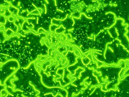 ഖത്തര്‍ മരുഭൂമിയില്‍ 'അതിഭീകരന്‍ ബാക്ടീരിയ'... സൂക്ഷിയ്ക്കണം