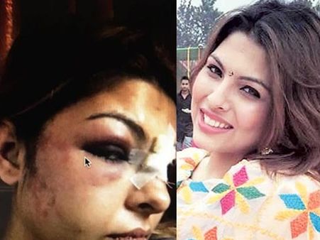 ദില്ലിയില്‍ ആത്മഹത്യ ചെയ്ത മോഡലിനെ ഭര്‍ത്താവ് പീഡിച്ചിരുന്നു,ചിത്രങ്ങള്‍ പുറത്ത് വിട്ട് സഹോദരി