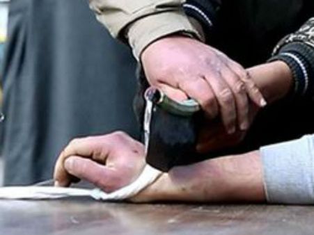 7 മാസം പ്രായമുള്ള മകളെ പീഡിപ്പിച്ച 17 കാരന്റെ ഇരുകൈകളും പിതാവ് വെട്ടിയെടുത്തു