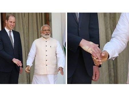 വില്യം രാജകുമാരന്റെ കയ്യില്‍ പതിഞ്ഞ പാടുകള്‍ ശരിക്കും മോദി ബലം പ്രയോഗിച്ചത് തന്നെയാണോ,,ഫോട്ടോ കാണൂ