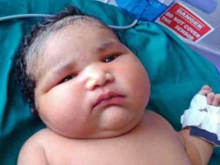 ലോകത്തിലെ ഏറ്റവും ഭാരം കൂടിയ പെണ്‍കുഞ്ഞിന് ഇന്ത്യക്കാരി ജന്മം നല്‍കി