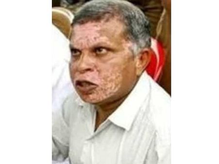 യുഡിഎഫ് കോട്ട തകര്‍ത്ത് കല്പറ്റയില്‍ സികെ ശശീന്ദ്രന് വിജയം