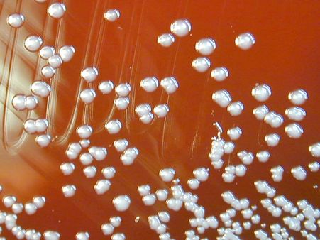 24 മണിയ്ക്കൂറിനുള്ളില്‍ തലച്ചോറിനെ തകര്‍ക്കുന്ന മാരകമായ ബാക്ടീരിയ, വീണ്ടും ഭീതി പടര്‍ത്തുന്നു