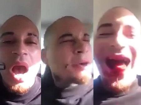 മ്യൂസിക് വീഡിയോ ഇന്റര്‍നെറ്റില്‍ വൈറലാകാന്‍ സ്വന്തം കവിളില്‍ വെടിവെച്ച് വീഡിയോ എടുത്തു, കാണൂ...