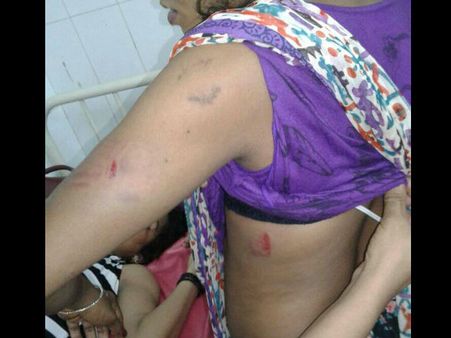 പരാതി പറയാനെത്തിയ ട്രാന്‍സ്ജന്റേര്‍സിനെ തല്ലി ചതച്ചു; കൊച്ചിയില്‍ പോലീസിന്റെ നരനായാട്ട്