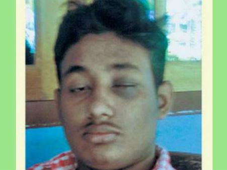 ചോര ഛര്‍ദ്ദിക്കും വരെ മര്‍ദ്ദനം; തമിഴ്‌നാട്ടില്‍ റാഗിംഗിനിരയായ വിദ്യാര്‍ത്ഥിയുടെ കാഴ്ച നഷ്ടപ്പെട്ടു