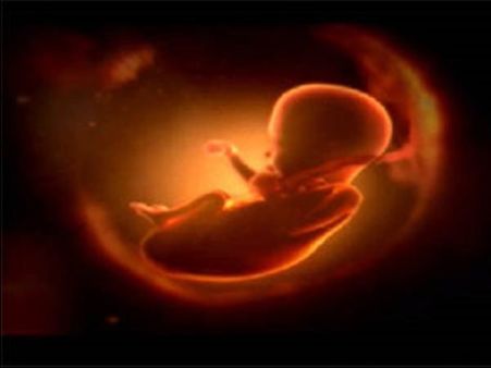 ഗര്‍ഭാവസ്ഥില്‍ മരിച്ച ഭ്രൂണത്തെ നീക്കം ചെയ്യാതെ 5 ദിവസം, ആദ്യം പണം പിന്നെ ശസ്ത്രക്രിയെന്ന് ഡോക്ടർ