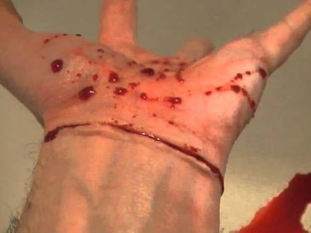 എസ്എഫ്‌ഐയുടെ റാഗിംഗ് ? എഞ്ചിനിയറിംഗ് വിദ്യാര്‍ത്ഥി ഞരമ്പ് മുറിച്ചു; കുസാറ്റ് അടച്ച് പൂട്ടി...