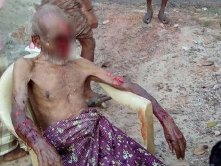 തെരുവ് നായ്ക്കള്‍ വീട്ടില്‍ കേറി കടിച്ചുകീറി: മെഡിക്കല്‍ കോളേജില്‍ പ്രവേശിപ്പിച്ച വൃദ്ധന്‍ മരിച്ചു