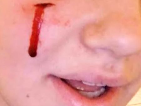 സണ്ണിയുടെ 'കടി' മാറിയിട്ടില്ല... വൈറ്റ് ഹൗസിലെത്തിയ പെണ്‍കുട്ടിയോട് ഒബാമയുടെ വളര്‍ത്തുനായ ചെയ്തത്...