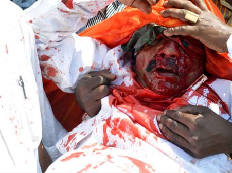 ബിജെപി നേതാവിന്റെ കാഴ്ച നഷ്ടപ്പെട്ടില്ല,എല്ലാം പച്ചക്കള്ളം? ഇങ്ങനെയൊക്കെ തള്ളണോ ബിജെപിക്കാരാ....