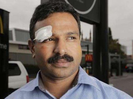 ഇന്ത്യക്കാരനല്ലേ എന്ന് ചോദിച്ച് ആക്രമണം!!ഓസ്‌ട്രേലിയയില്‍ കോട്ടയം സ്വദേശിക്ക് നേരെ വംശീയ അതിക്രമം!