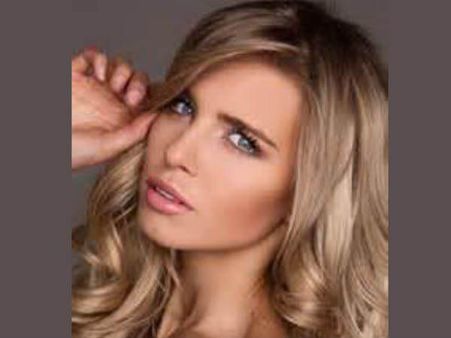 വന്യമൃഗത്തിന്റെ ആക്രമണത്തിന് ഇരയായ മുന്‍ ലോകസുന്ദരിയുടെ നില ഗുരുതരം !!! കഴുത്തിനും കൈയ്ക്കും പരിക്ക്