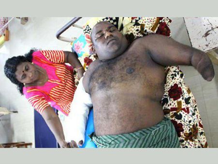 മറുകൈ കൊണ്ട് തടയില്ലെന്ന് ഉറപ്പുള്ളത് കൊണ്ട് അവർ വെട്ടി!!!അംഗപരിമിതനായ എസ്എഫ്ഐ നേതാവിന് നേരെ ആക്രമണം