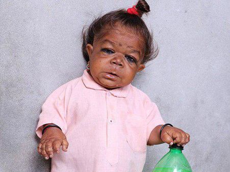 ഈ ഇത്തിരിക്കുഞ്ഞനാണ് ഒരു നാടിന്റെ ദൈവം !!! വേണ്ടത് ചികിത്സയെന്ന് ഡോക്ടർമാർ...