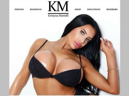 100ഓളം പ്ലാസ്റ്റിക് സർജറികൾ, മരണവും പ്ലാസ്റ്റിക് സർജറിയ്ക്ക് ഇടേ!! മോഡലിന്റെ ജീവിതം