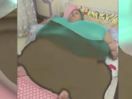 ഇമാന്‍ അഹമ്മദ് മെലിയുന്നു; കുറച്ചത് 250 കിലോ ഭാരം; മാറ്റത്തില്‍ അത്ഭുതപ്പെട്ട് ലോകം