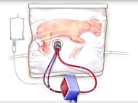 ഇനി പത്ത് മാസം വയറ്റിൽ ചുമക്കണ്ട, ഡ്യൂപ്ലിക്കേറ്റ് റെഡി !!! വന്ധ്യതയ്ക്ക് പരിഹാരം