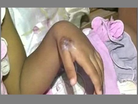 ചൂടുകറി ദേഹത്തു വീണു, രണ്ടു വയസ്സുകാരന്‍ വെന്തുമരിച്ചു