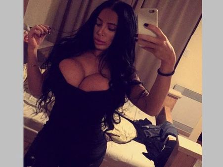 100 പ്ലാസ്റ്റിക് സര്‍ജറികള്‍ വന്‍വിജയം.. ചൂടന്‍ മോഡലിന് നൂറ്റിയൊന്നാം സര്‍ജറിയില്‍ സംഭവിച്ചത്...!!!