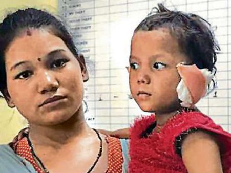 മകളുടെ നന്മക്കു വേണ്ടി അച്ഛൻ മൂന്നു വയസുകാരിയുടെ ചെവി മുറിച്ചെടുത്തു!!!