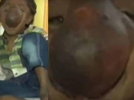 തുമ്പിക്കൈ മൂക്കുമായി ഗണേഷ്...!! ഗണപതിയുടെ അവതാരമാക്കി ആരാധിച്ച് ഒരു ഗ്രാമം...!! വീഡിയോ...!