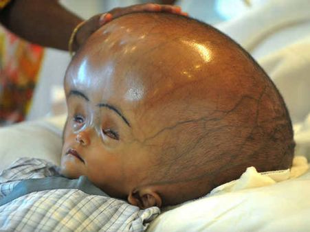 ഒമ്പതാമത്തെ ശസ്ത്രക്രീയക്കു കാത്തുനിന്നില്ല!!! റൂണ ബാഗം മരണത്തിന് കീഴടങ്ങി!!