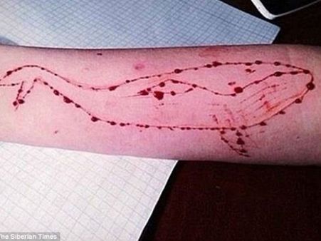 അര്‍ദ്ധരാത്രിയില്‍ ബൈക്കില്‍ കറക്കം: കയ്യില്‍ ബ്ലൂ വെയ് ല്‍ ചിത്രം, ആത്മഹത്യാശ്രമം!