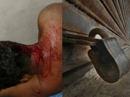 കണ്ണൂർ വീണ്ടും അശാന്തമാകുന്നു.. സിപിഎം പ്രകടനത്തിന് നേരെ ബോംബേറ്.. പാനൂരിൽ ഹർത്താൽ