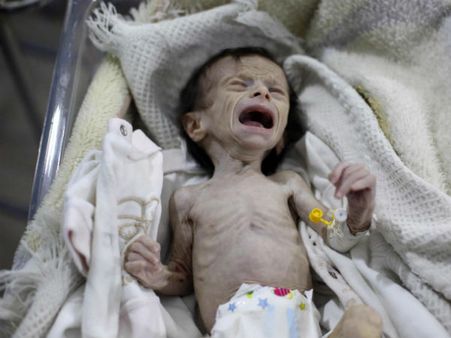 വൈക്കോലും ചപ്പുചവറുകളും ഭക്ഷിക്കുന്നവർ; വിശന്ന് കരയുന്ന കുട്ടികൾ! സിറിയയിൽ കൊടുംപട്ടിണി...