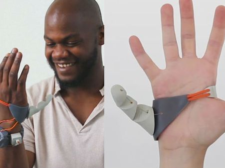 ആറാം വിരലിനോട് അറപ്പ് വേണ്ട.. ഭാഗ്യവിരലാണ്.. കൈക്കുള്ളിലൊതുങ്ങുന്ന ജോലികൾ ഇനി എന്തെളുപ്പം