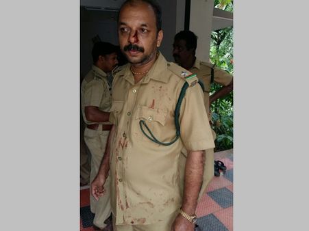 നായാട്ടു സംഘത്തിന്റെ ആക്രമണത്തിൽ ഫോറസ്റ്റ് ഓഫീസർ ഉൾപ്പെടെ നാല് പേർക്ക് പരിക്ക്