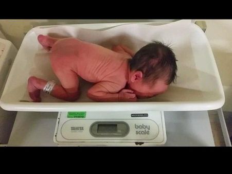 ഗുജറാത്തില്‍ ശിശുമരണം: മൂന്ന് ദിവസത്തിനിടെ 18 കുട്ടികള്‍! പോഷകാഹാരക്കുറവും ഭാരക്കുറവും !