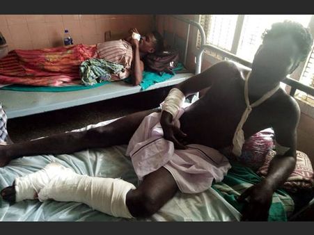 പണമില്ലാത്തതിനാല്‍ കേരളം കയ്യൊഴിഞ്ഞ തമിഴ് യുവാവിന് തുണയായത് കോയമ്പത്തൂരില്‍ മെഡിക്കല്‍ കോളജ്