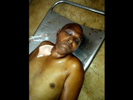 തലയില്‍നിന്നും രക്തംവാര്‍ന്ന് തിരൂര്‍ ജില്ലാ ആശുപത്രയില്‍ പ്രവേശിപ്പിച്ച തമിഴ് യുവാവ് മരിച്ചു