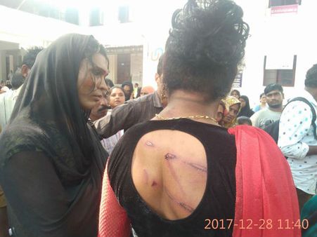 ''നിങ്ങളൊക്കെ ചാവേണ്ടവരാണ്''.. കോഴിക്കോട് റോഡിലിട്ട് ഭിന്നലിംഗക്കാരെ ക്രൂരമായി തല്ലിച്ചതച്ച് പോലീസ്