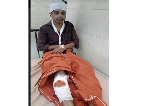 ബൈക്ക് തടഞ്ഞു നിർത്തി മിന്നലാക്രമണം;രണ്ട് കോളേജ് വിദ്യാർത്ഥികൾക്ക് പരുക്ക്