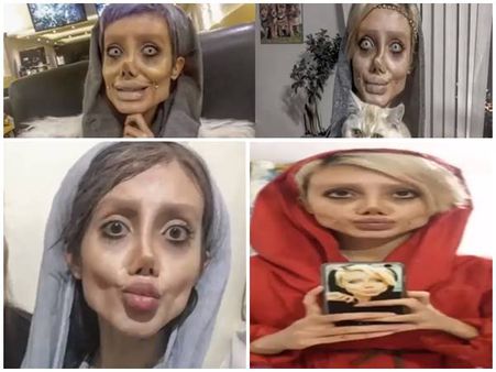 ആഞ്ചലീന ജോളിയാവാൻ ആഗ്രഹം; ചെയ്തത് 50 ശസ്ത്രക്രിയ, മാസങ്ങൾ നീണ്ട ഡയറ്റ്, എന്നാൽ ഇപ്പോഴോ.... ഭീകരം!