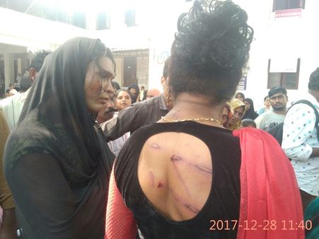 ട്രാൻസ്ജെൻഡേഴ്സിനു നേരെ നഗരത്തിൽ പൊലീസ് അതിക്രമം