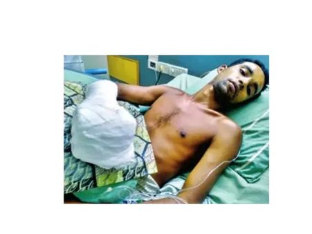 കാട്ടാനക്കൂട്ടത്തെ തുരത്താന്‍പോയ വാച്ചറുടെ കൈയിലിരുന്ന പടക്കംപൊട്ടി വിരലുകള്‍ അറ്റു