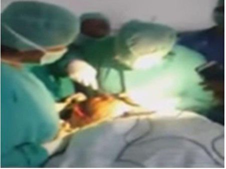 ആശുപത്രിയിൽ കറൻറില്ല മൊബൈൽ ടോർച്ച് വെളിച്ചത്തില്‍ ശസ്ത്രക്രിയ..