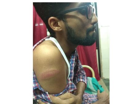 കുറ്റ്യാടിയില്‍ കാഴ്ച കുറഞ്ഞ വിദ്യാര്‍ഥിക്കുനേരെ പൊലീസ് അതിക്രമം