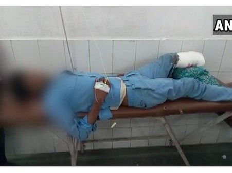 ആക്സിഡന്റിൽ അറ്റുപോയ കാൽ അതേ രോഗിക്ക് തലയണയാക്കുന്ന യോഗിയുടെ യുപി മോഡൽ.. ഞെട്ടിക്കുന്ന വീഡിയോ കാണാം!